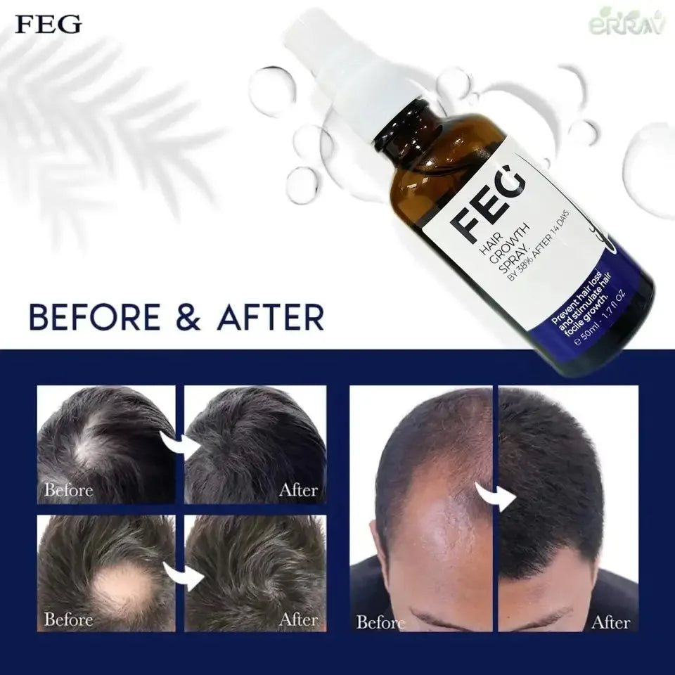 Last Day Of Discount š„ PLUS Hair Growth Spray