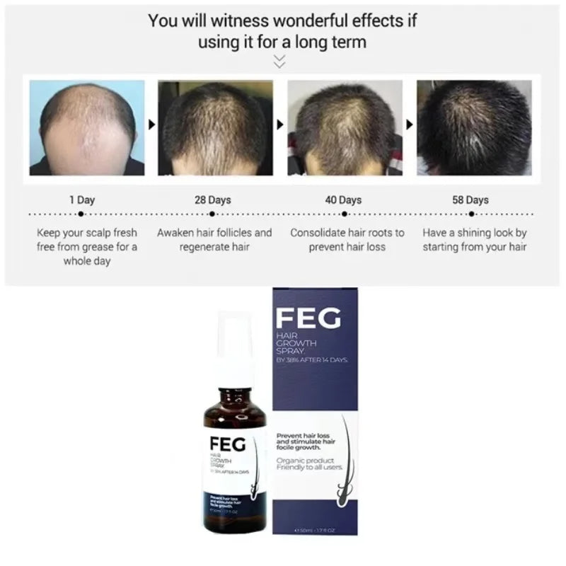 Last Day Of Discount š„ PLUS Hair Growth Spray