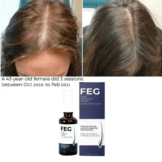 Last Day Of Discount 🔥 PLUS Hair Growth Spray